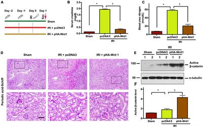 Exogenous Wnt1 Prevents Acute Kidney Injury and Its Subsequent Progression to Chronic Kidney Disease